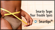 SmartLipo™ - Smartly Target Your Trouble Spots