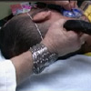 Tattoo Removal Video
