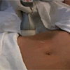 Velashape Video